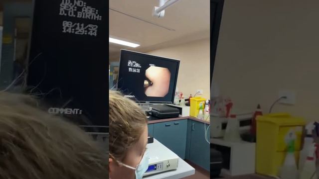 Endoscopic removal of gastric foreign body from a cat смотреть онлайн