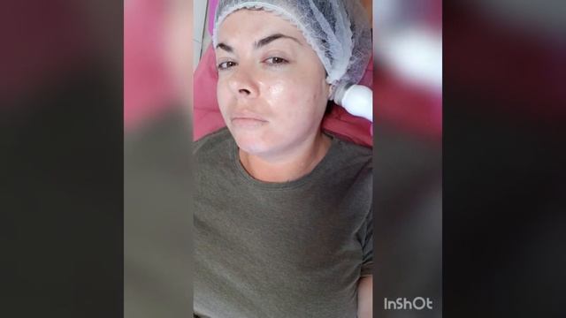 Гидропилинг смотреть онлайн