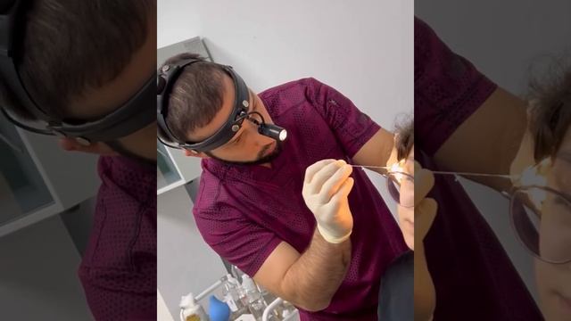 Вот что образуется в ушах. Лор-врач Эльдар Мазумович промыл уши пациентам и достал «клад» ?