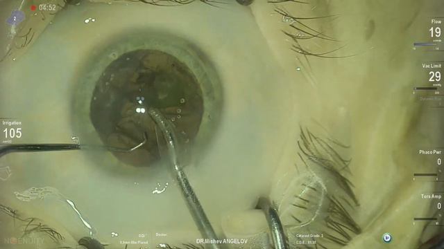 Anton Angelov Vista Live Stream смотреть онлайн