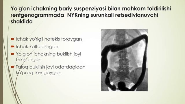 Хазм тизимининг уткир ва сурункали касалликарида хамширалик жараени Хазм тизимининг тизимининг пат смотреть онлайн