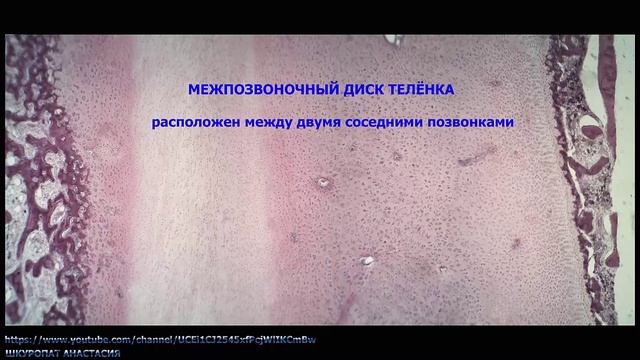 Гистологический препарат "Волокнистая хрящевая ткань" смотреть онлайн