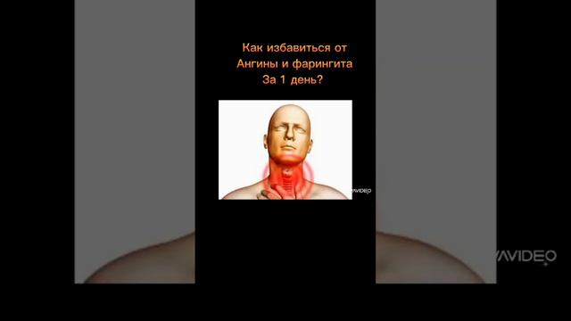 КАК ИЗБАВИТЬСЯ ОТ АНГИНЫ И ФАРИНГИТА ВСЕГО ЗА 1 ДЕНЬ??? смотреть онлайн