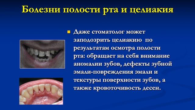 Целиакия. Детские корни взрослых проблем смотреть онлайн