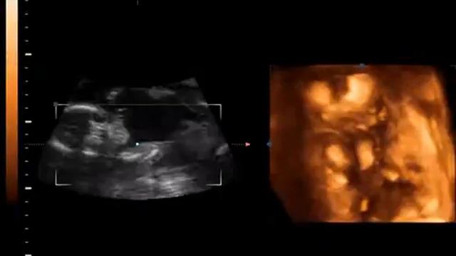 УЗИ Полина смотреть онлайн