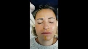 Пилинг Биорепил