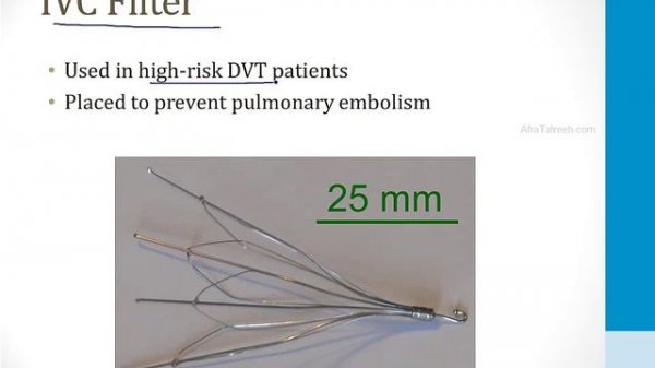 Pulmonary - 3. Other Pulmonary Topics - 8.Pulmonary Embolism atf