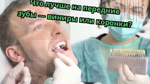 Что лучше на передние зубы — виниры или коронки? смотреть онлайн