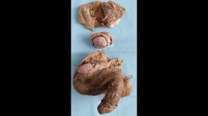 Мужские половые органы