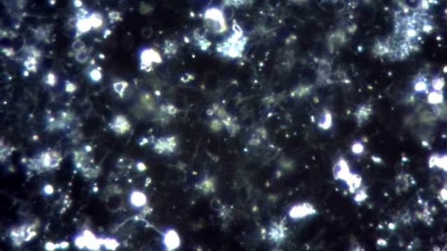 Enfermedad de Lyme, Borrelia, Espiroquetas Nº8 смотреть онлайн