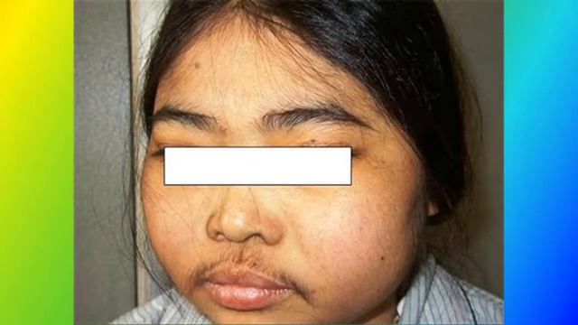 Ẩn họa từ corticoid Vẫn còn thời sự смотреть онлайн