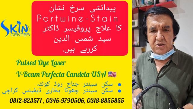 Portwine stain treatment with Vbeam perfecta laser by Dermatologist Prof. Dr. Shamsuddin смотреть онлайн