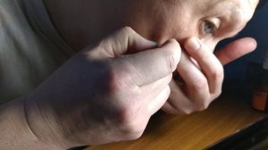 Удалить жировик на лице. Дома.