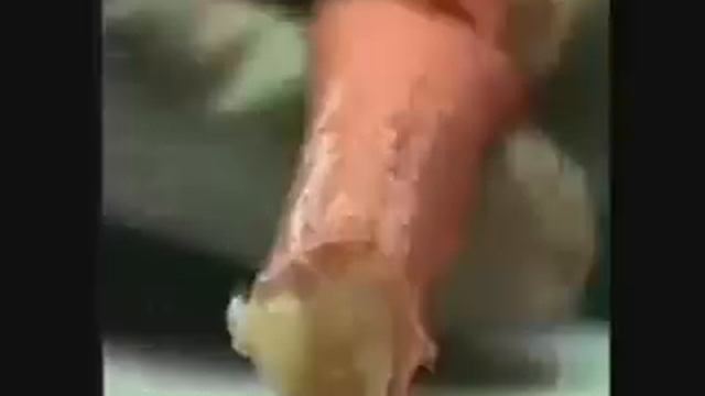 Аорта.mpg смотреть онлайн