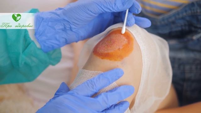 97% людей не знают: в каких случаях применять зеленку, а в каких йод! Вот что случается смотреть онлайн