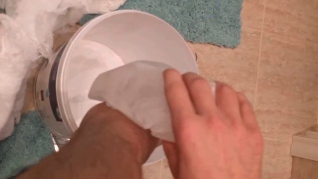 Двухлодыжечный перелом: Снятие гипса (День 3) смотреть онлайн