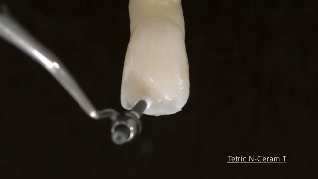 Tetric N Line (Ivoclar Vivadent) смотреть онлайн