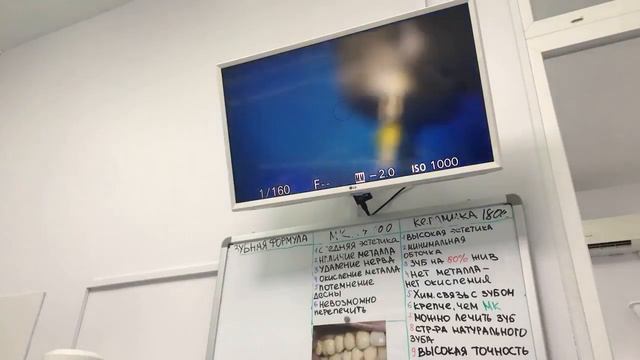 Лечение 17 зуба , лечим ассистента Дашу , лечение зубов , ставим пломбу , сверлим кариес смотреть онлайн