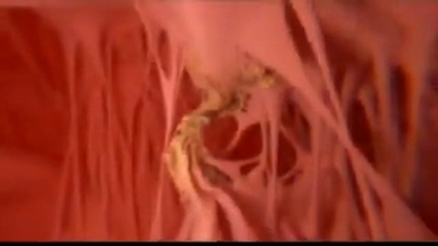 Боли в сердце - признак .... смотреть онлайн