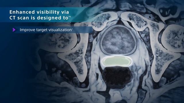 See more* with SpaceOAR Vue™ Hydrogel смотреть онлайн