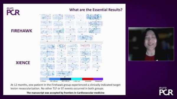 Исследование стентов Firehawk на PCR 2022 - TARGET STEMI OCT China Trial