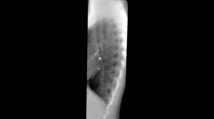 Укладка грудного отдела позвоночника