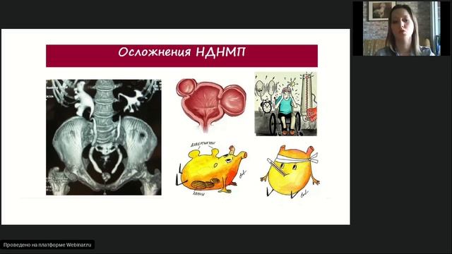 Нейрогенная дисфункция нижних мочевыводящих путей.  Д.м.н. Филиппова Е.С.