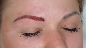 Удаление татуажа ремувером. Как удалить переманентный макияж бровей (вся процедура)