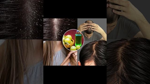 amla balo me lagane ke fayde |#Health_tips_official #short_video#aloevera #ytshort#hairgrowth #hair смотреть онлайн