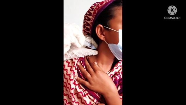 FNAC in the Diagnosis of Posterior Cervical Lymph Nodes Maligancies।। смотреть онлайн