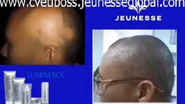 Омоложение лица и тела! Продукция Жанес Глобал Jeunesse Global ss0i0tF6PVM x264 смотреть онлайн