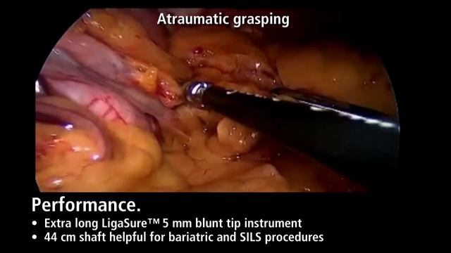 Применение системы LigaSure