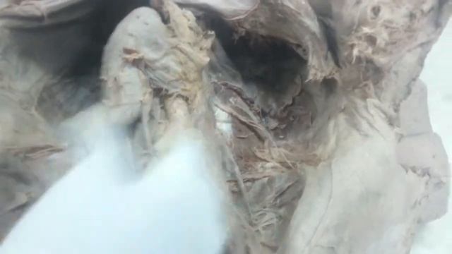 GIT System l Anterior Abdominal Wall l Section 7 смотреть онлайн