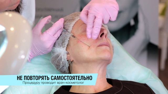Процедура - убираем носогубки с помощью канюли смотреть онлайн