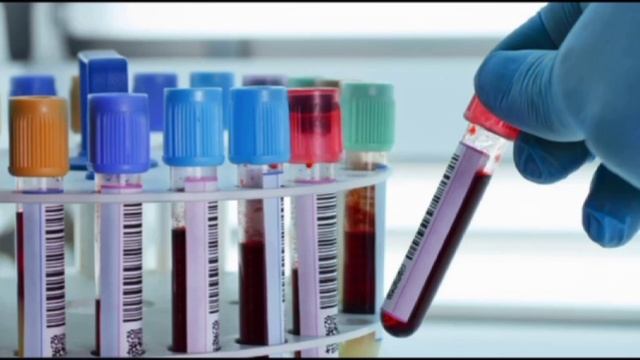 ЛАБОРАТОРНАЯ ДИАГНОСТИКА.mp4