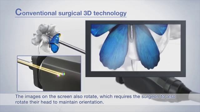 ENDOEYE FLEX 3D Technology смотреть онлайн