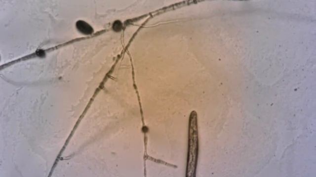 Root knot nematode captured with nematophagous fungi смотреть онлайн