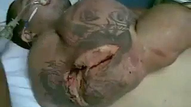 Лопнула мышца больше не покачается смотреть онлайн