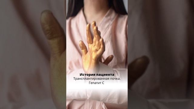 ИСТОРИЯ ПАЦИЕНТА - ТРАНСПОРТИРОВАННАЯ ПОЧКА. ГЕПАТИТ C смотреть онлайн