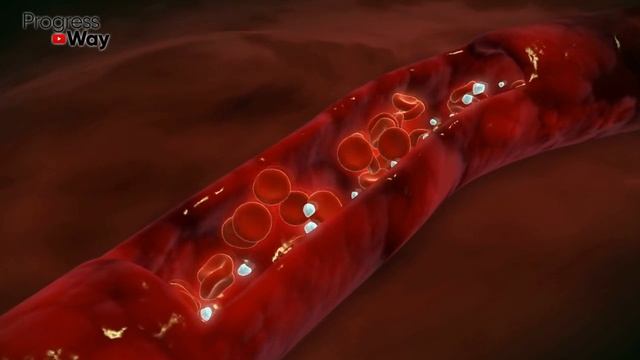 Моя Бабушка 87 лет Вывела комочки солей с помощью ЛАВРОВОГО ЛИСТА! Суставы больше не беспокоят!