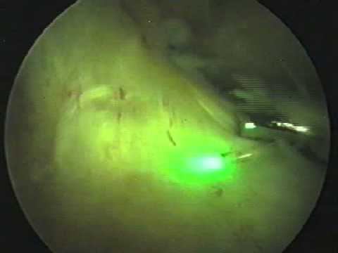 Современные методы лечения повреждения коленного сустава в Бест Клиник смотреть онлайн