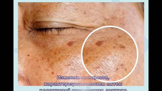 13 РАННИХ ПРИЗНАКОВ, ЧТО ВАША ПЕЧЕНЬ ОТМИРАЕТ! 90% ДАЖЕ НЕ ЗАДУМЫВАЛИСЬ ОБ ЭТОМ… смотреть онлайн