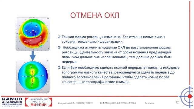 ОРТО-к индуцированный роговичный астигматизм – Андриенко Гульнара Владимировна смотреть онлайн