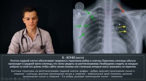 Научись читать РЕНТГЕН за 19 минут!!! Рентген снимок грудной клетки!