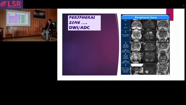 Prostate Imaging Reporting & Data System (PI-RADS), By Dr. Hatem Eshmila смотреть онлайн