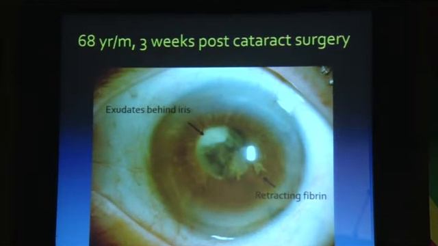 AIOC2017 - IC362 - Dr. Satanshu Mathur (19.02.2017 / 12:00-13:25 / HALL: E) смотреть онлайн