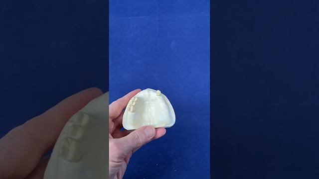 Jaw Registration. Centric Relation Or Centric Occlusion For Removable Partial Dentures ??♂️