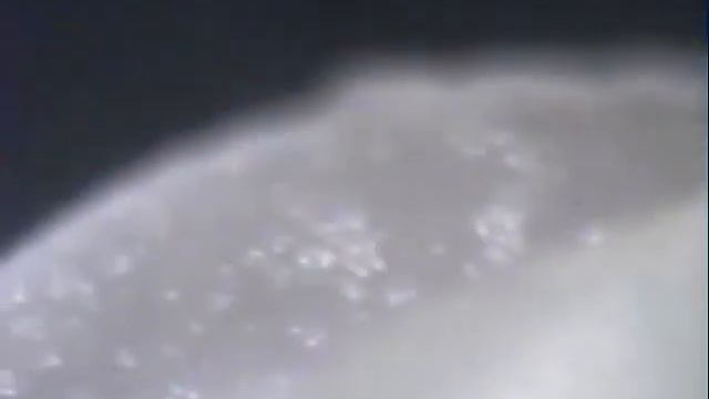Trematode -Morgellon series- lunar3society Clip0197.WMV смотреть онлайн