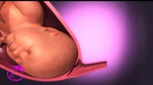 Роды ребенка