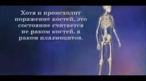 Множественная миелома